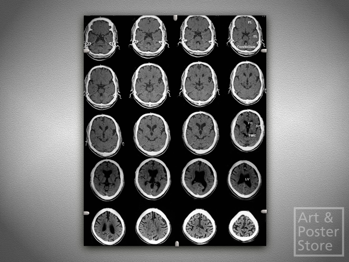 Second Life Marketplace - Brain Scan | Graphic Photo Poster | Mesh Clip ...
